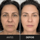 FaceLift Pro™ – Massageador Facial LED 3 em 1 | Anti-Rugas e Papada