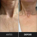 FaceLift Pro™ – Massageador Facial LED 3 em 1 | Anti-Rugas e Papada